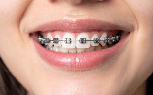 Orthodontics